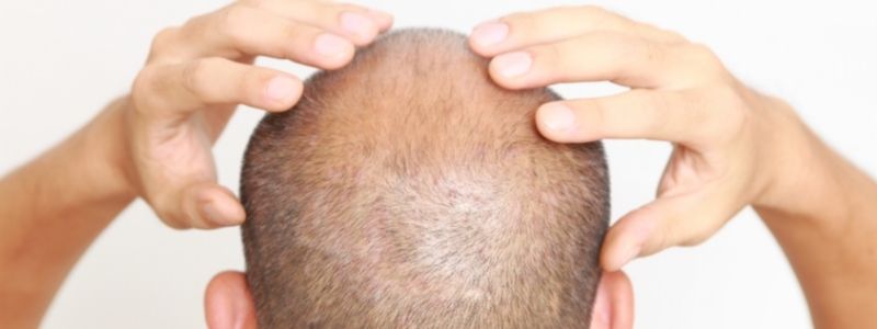 Kopfmassage-nach-Haartransplantation