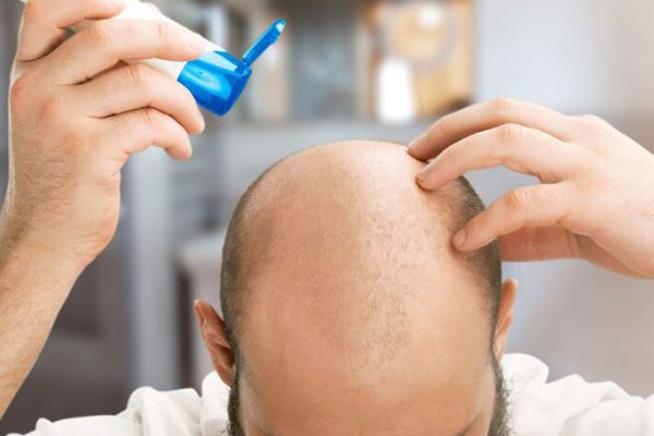 Spraying-Saline-After-Having-a-Hair-Transplant