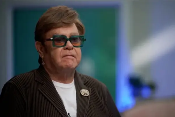 elton-john-hair-transplant