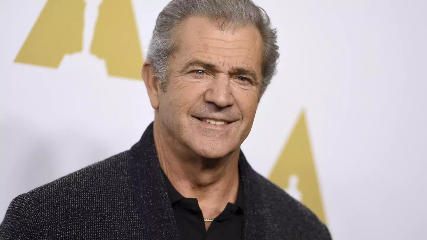 mel-gibson-hair-transplant